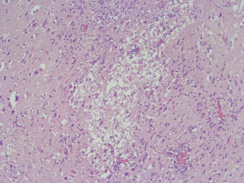 P24-175_midbrain_lateral x 10